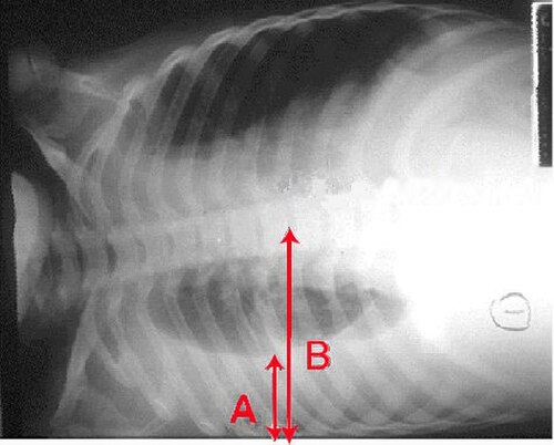 CXR teaching image preview