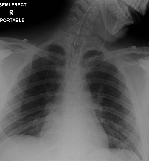 CXR teaching image preview