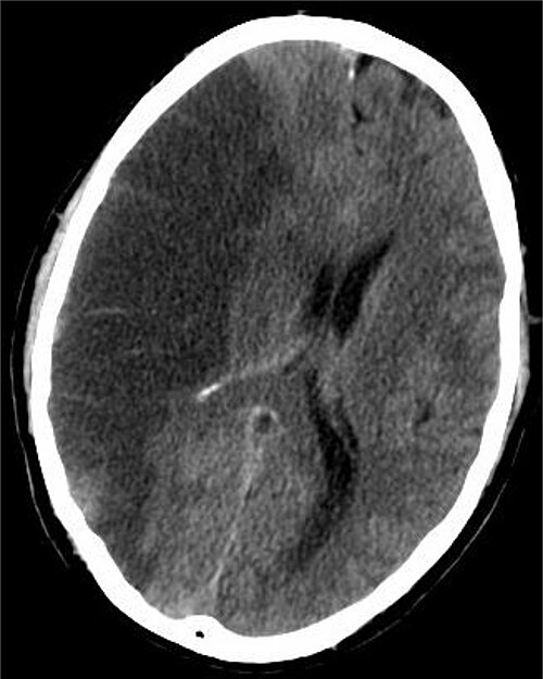 CT Brain teaching image preview
