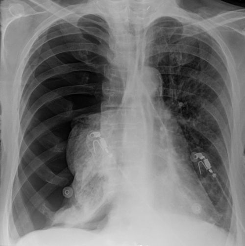 CXR teaching image preview
