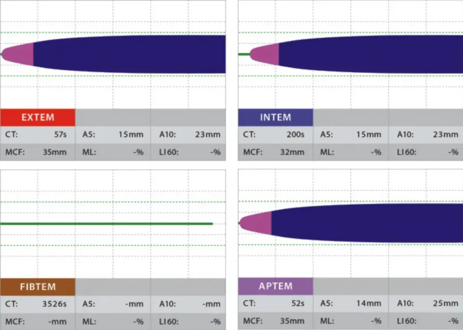 ROTEM Clinical Trace Low Fibrinogen