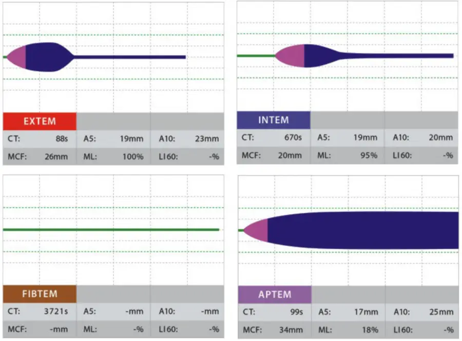 ROTEM Clinical Trace Mixed Trauma Coagulopathy