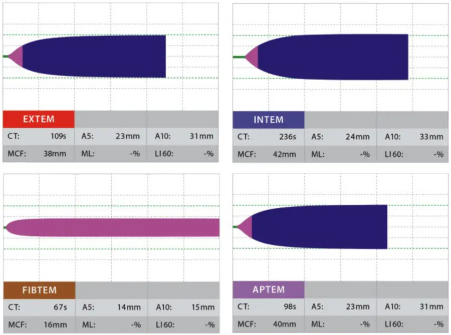 ROTEM Clinical Trace Platelet Limited