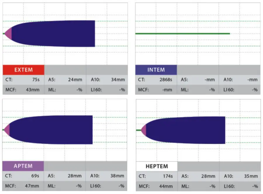 ROTEM Clinical Trace Residual Heparin