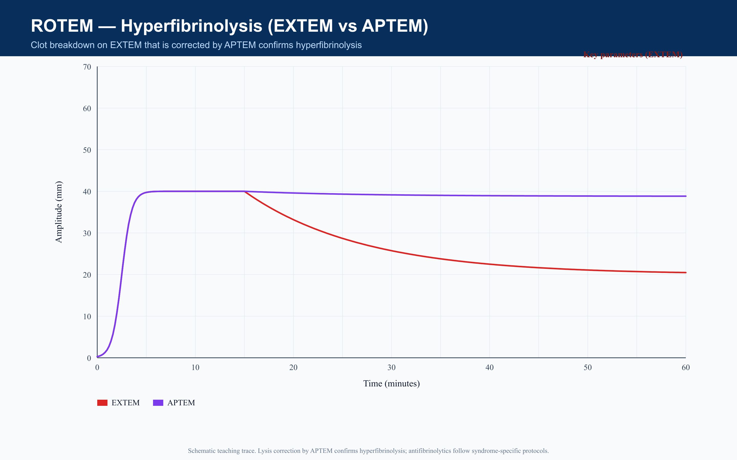 ROTEM Hyperfibrinolysis (EXTEM vs APTEM)