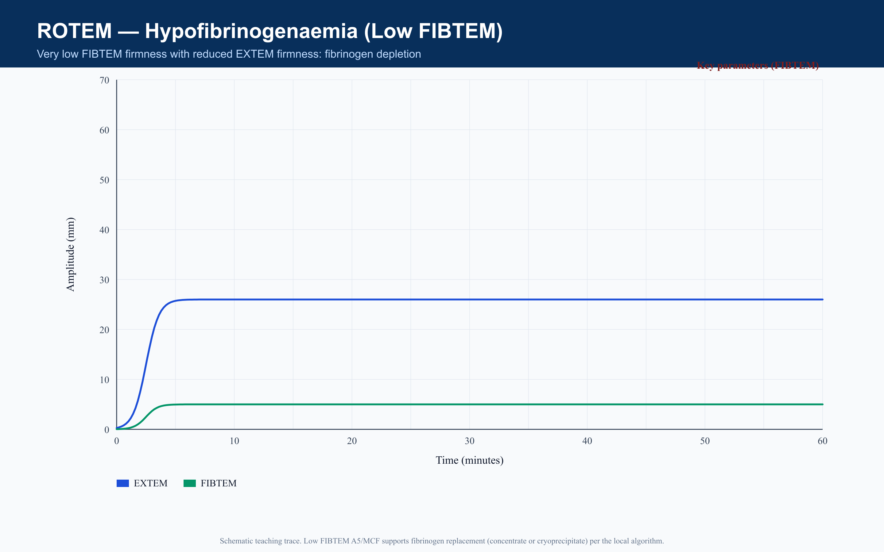 ROTEM Hypofibrinogenaemia (Low FIBTEM)