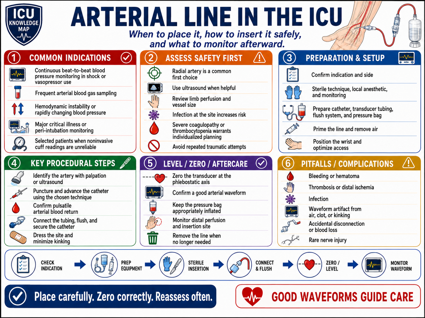 Arterial Line in the ICU — At-a-Glance Summary